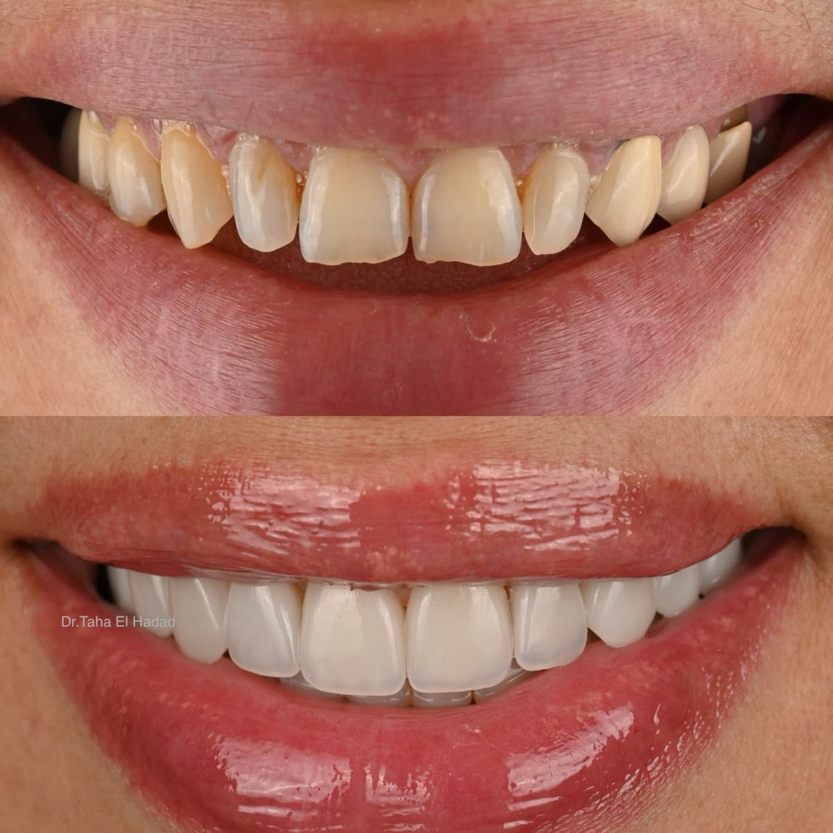 Salle de soins dentaires moderne et équipée de Master Smile Clinic, cabinet dentaire à Casablanca